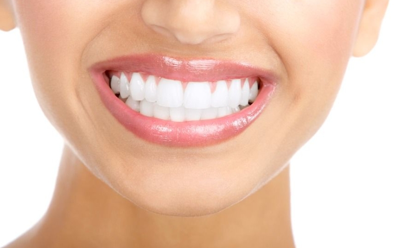 Is teeth whitening safe for your teeth
